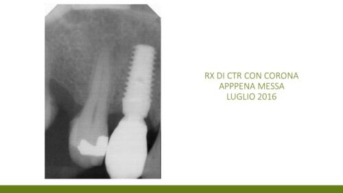 DellaTorre-M.-Conical Grade-Diapositiva11