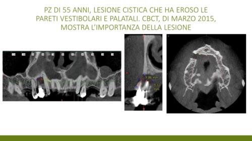 DellaTorre-M.-Conical Grade-Diapositiva2