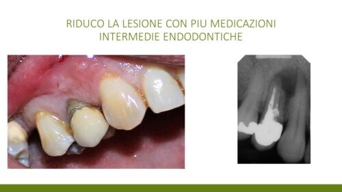 DellaTorre-M.-Conical Grade-Diapositiva3