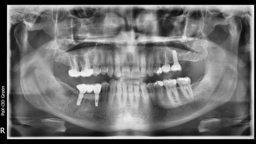Dott. Arturo Marrone - Conical Grade 2