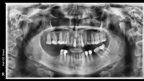 Dott. Arturo Marrone - Conical Grade 3